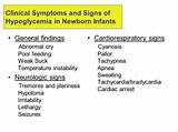 Clinical Seizures Symptoms Photos