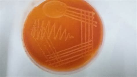 Macconkey Agar Plate Showing Growth Of Acinetobacter Baumannii