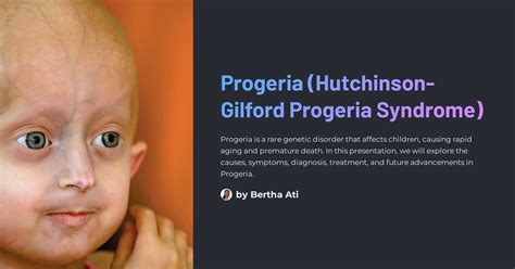 Progeria Hutchinson Gilford Progeria Syndrome