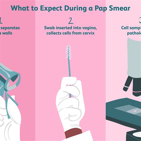 All 102 Images Pictures Of Pap Smear Procedure Excellent
