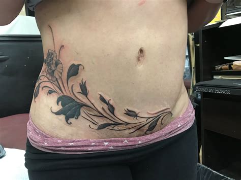 Top More Than 71 Tummy Tuck Tattoo Cover Best Esthdonghoadian
