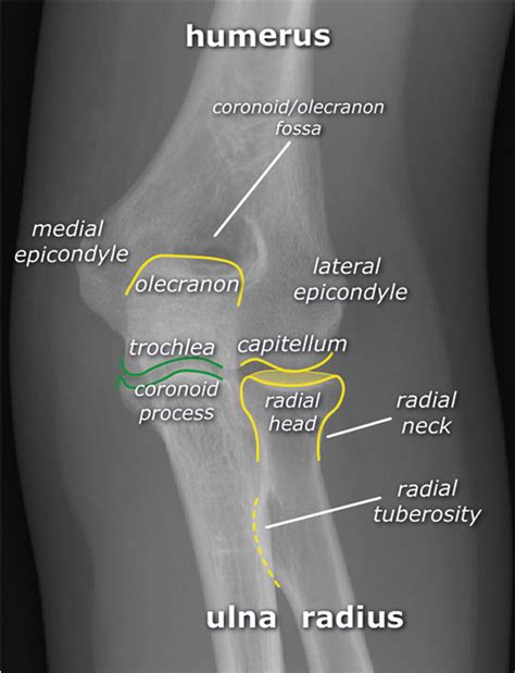 Radius Bone Labelled Ulna Definition Location Anatomy Functions