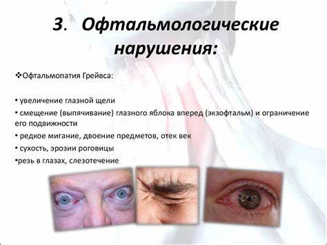 Диета и гипертиреоз Гипертиреоз (тиреотоксикоз) - презентация онлайн Гипертиреоз (тиреотоксикоз) - презентация онлайн Диета и гипертиреоз