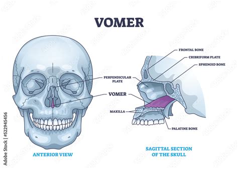 Vomer Bone With Facial Skeleton And Frontal Nasal Cavity Outline