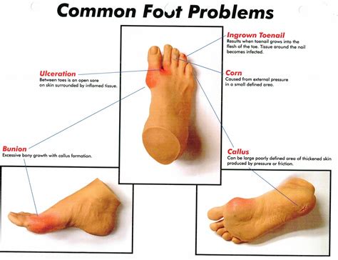 Foot Problems And The Podiatrist