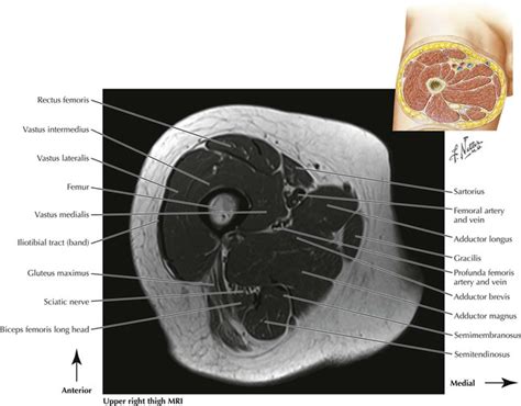 Like the forearm, the upper leg, or thigh, has a dense arrangement of . Lower Limbs | Radiology Key