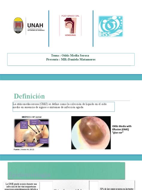 Otitis Media Serosa Pdf Medicina Clinica Cabeza Y Cuello Humanos