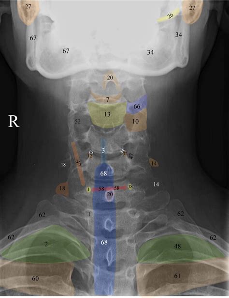 Normal Radiographic Anatomy Of The Cervical Spine Hip