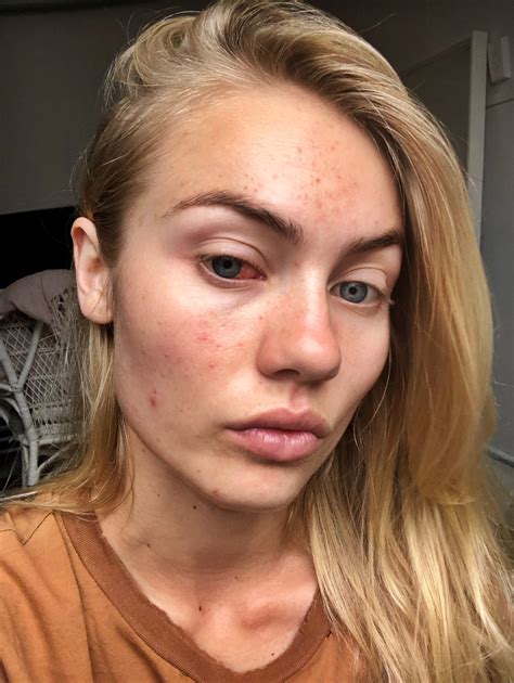 Elyse Knowles Without Makeup - No Makeup Pictures - Makeup-Free Celebs