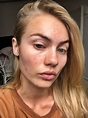 Elyse Knowles Without Makeup - No Makeup Pictures - Makeup-Free Celebs