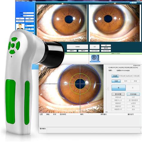 Portable USB 12MP Eye Iris Scanner Analyzer Iris Test Machine USB