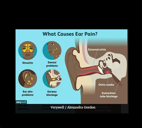 Causes Of Ear Pain And Treatment Options Frontlineer Dallas
