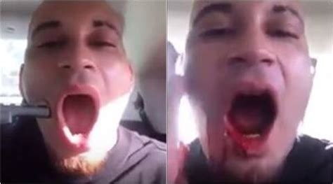 Video Wannabe Rapper Shoots Himself In The Face Just So His Video Could Go Viral Trending