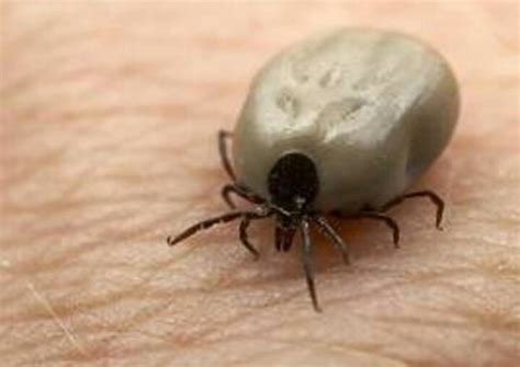 Remove Deer Tick Beauty Health And Nutrition Pinterest