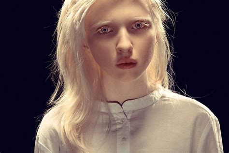 Nastya Kiki Zhidkova Albino Model Beauty Beautiful People