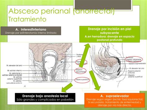 Ppt Patología Anorrectal Benigna Powerpoint Presentation Free