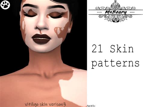 Msbearys Vitiligo V3 Sims 4 Mm Cc Sims Four Vitiligo Skin The Sims