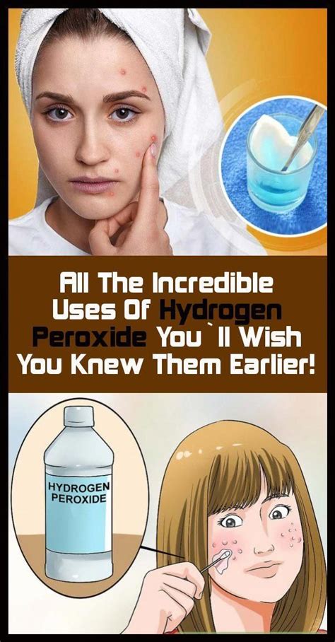 All The Incredible Uses Of Hydrogen Peroxide You`ll Wish You Knew Them