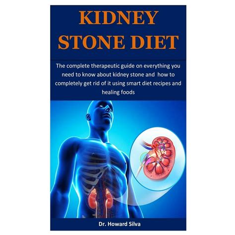 Kidney Stone Diet The Complete Therapeutic Guide On Everything You