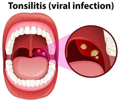 Background Of The Tonsils Anatomy Illustrations Royalty Free Vector
