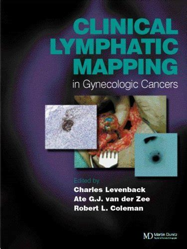 Clinical Lymphatic Mapping Of Gynecologic Cancer Medical Books Free