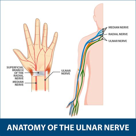 Ulnar Neuritis Information Florida Orthopaedic Institute