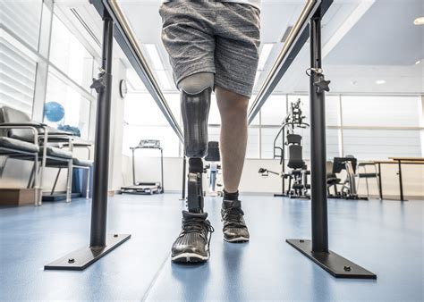 Leg Prosthesis Types