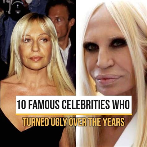 10 Famous Celebrities Who Turned Ugly Over The Years Celebrity 10