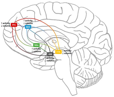 Brain Sciences Free Full Text Association Between Chronic Pain And