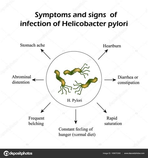 Helicobacter Pylori Symptoms Of Infection Infographics Vector