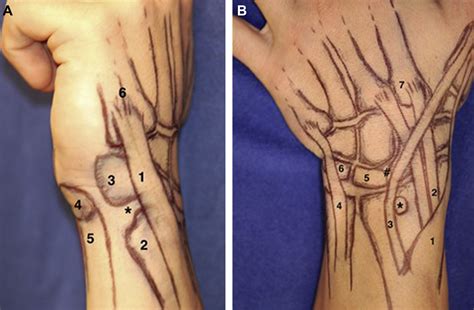 Examination Of Ulnar Sided Wrist Pain Hand Clinics