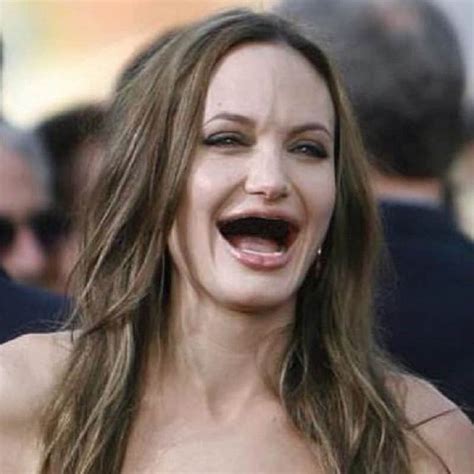 10 Hilarious Photos Of Celebrities Without Teeth