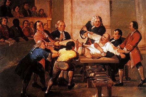 Leg Amputation 18th Century England Surgeon Doctor Medicine Physicians