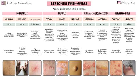 Lesiones Primarias De La Piel Parte Dermatolog A Piel Cosas De