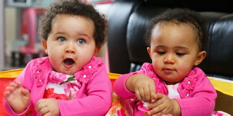 mixed race twins born with identical dna but different skin colors