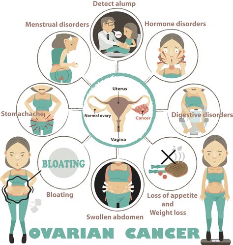 Some of them will be noticed by the woman, but others will be missed. Know These: 10 Signs and Symptoms of Ovarian Cancer - One ...
