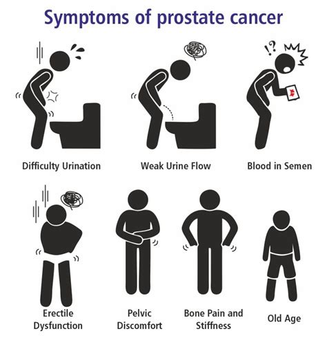 Prostate Cancer Symptoms Treatment And Diagnosis Vijaya Diagnostic