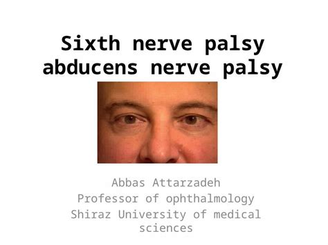 Pptx Sixth Nerve Palsy Abducens Nerve Palsy Abbas Attarzadeh
