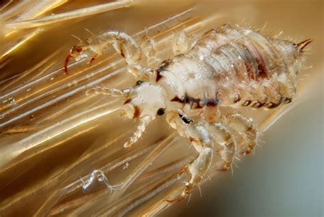 What Do Head Lice And Nits Look Like Lyclear