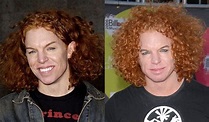 Carrot Top before and after plastic surgery 01 – Celebrity plastic ...