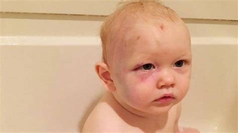 Justiceforjacob Story Of One Year Old Beaten By Babysitter Goes Viral