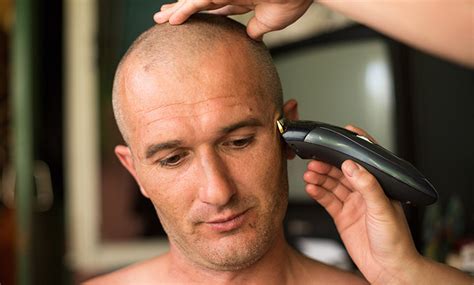 The Top 6 Haircuts For Balding Men Medical Man Cave
