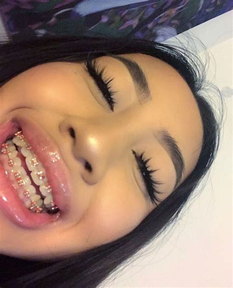 Pin By Supremebrat On Makeup Looks Braces Girls Cute Braces Colors