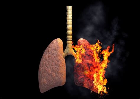 Smoker`s Lungs On Fire From Excessive Use Of Cigarettes Concept Of