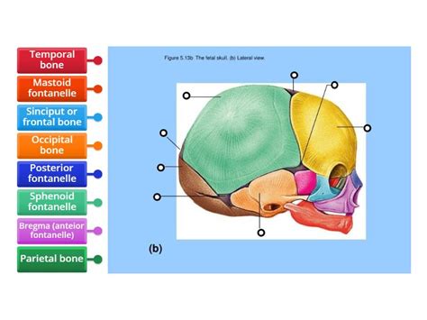 Fetal Skull Bone Lateral View Labelled Diagram