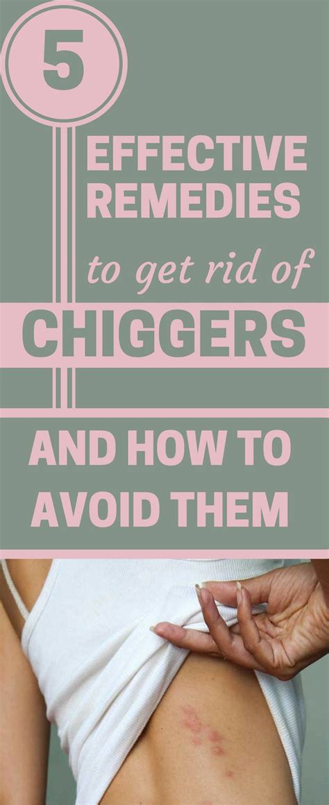 How To Get Rid Of Chiggers In Bed Prevent And Ways To Resolve Otosection