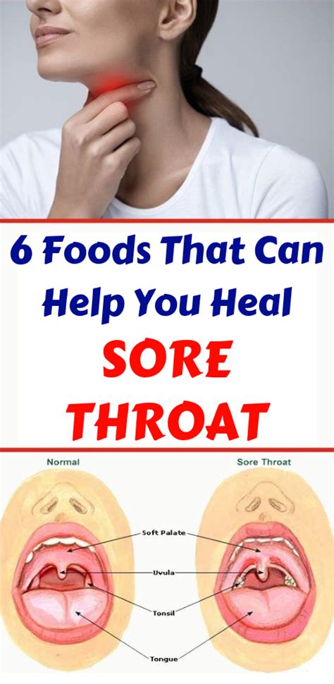 6 Foods To Eat When You Have A Sore Throat