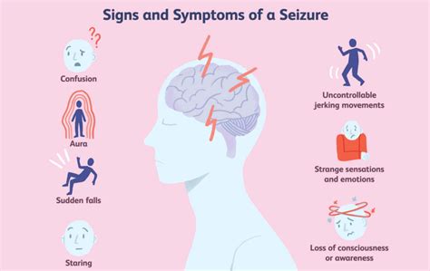 epilepsy symptoms causes diagnosis treatment and more