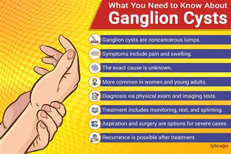 Ganglion Cyst Symptoms And Causes Mayo Clinic Ganglion Cyst Removal