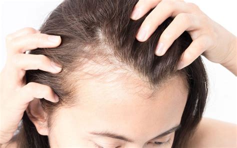 Grow Baby Hair On Forehead Skin Care Top News